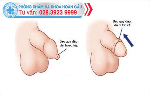 phong kham hoan cau quan 5